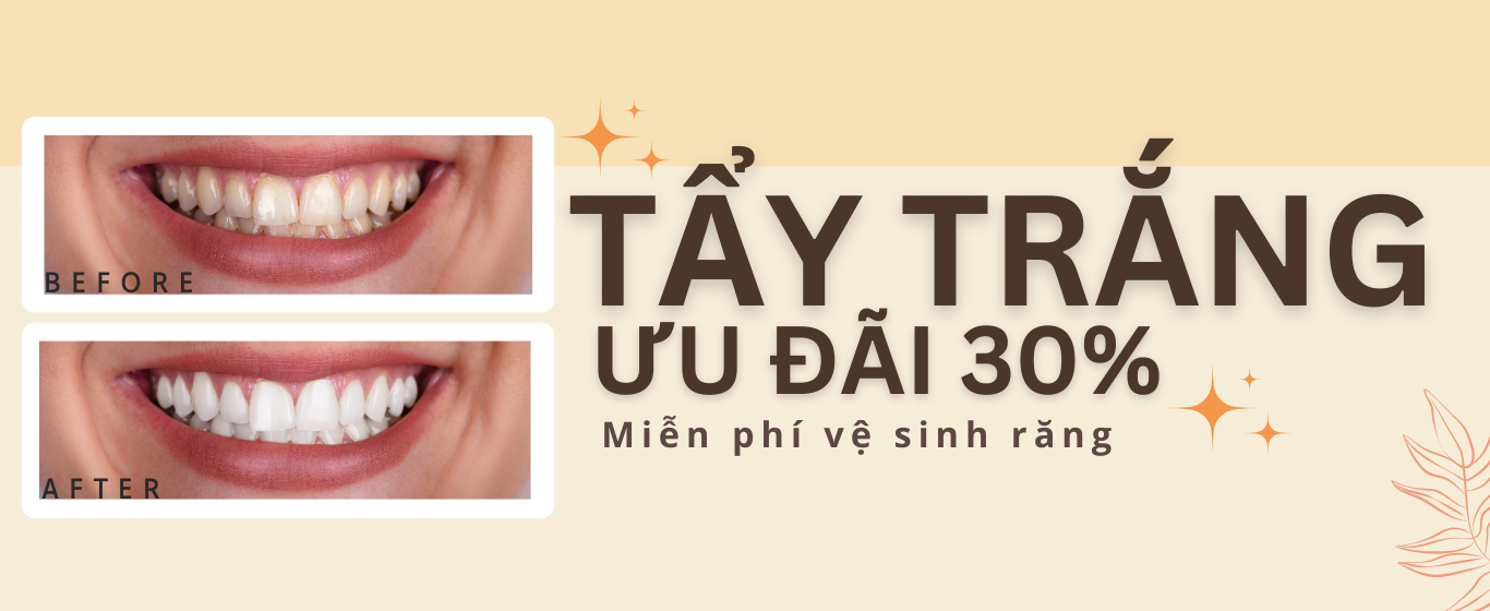 TẨY TRẮNG