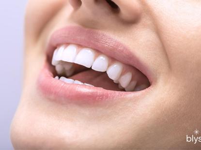 Tẩy trắng răng bằng đèn Plasma