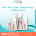 QUY TR&Igrave;NH TRỒNG RĂNG IMPLANT CHUẨN Y KHOA