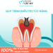 QUY TR&Igrave;NH ĐIỀU TRỊ TỦY RĂNG