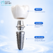Trồng Răng Implant L&agrave; G&igrave;?