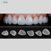 VENEER SỨ THẨM MỸ