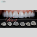 Dán Răng Sứ Veneer 